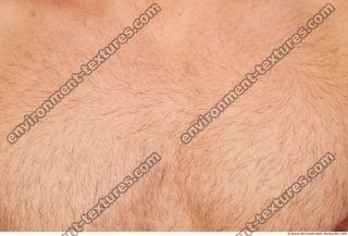 human skin hairy 0006